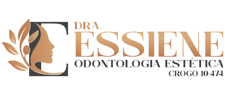 ODONTOLOGIA ESTÉTICA - FACETAS DE PORCELANA